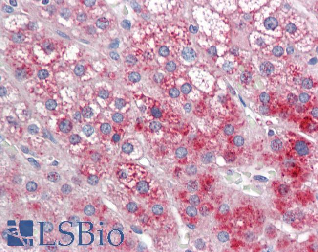 Human Adrenal: Formalin-Fixed, Paraffin-Embedded (FFPE)