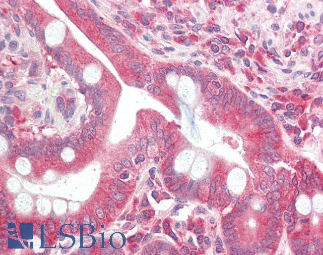 Anti-DCP2 antibody IHC staining of human small intestine. Immunohistochemistry of formalin-fixed, paraffin-embedded tissue after heat-induced antigen retrieval.