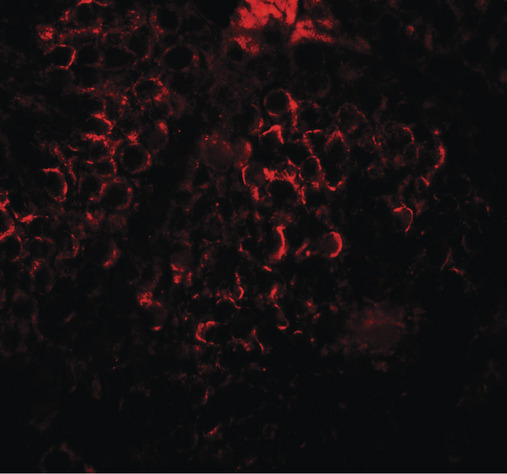 Immunofluorescence of DCP2 in human testis tissue with DCP2 antibody at 20 ug/ml.