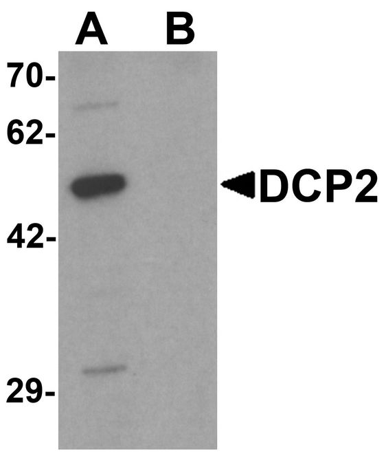 Western blot analysis of DCP2 in 293 cell lysate with DCP2 antibody at 1 ug/ml in (A) the absence and (B) the presence of blocking peptide.