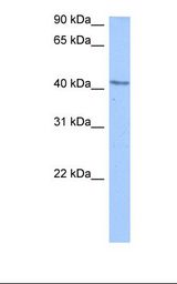 Jurkat cell lysate. Antibody concentration: 0.5 ug/ml. Gel concentration: 12%.
