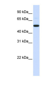 DCP2 antibody LS-C110609 Western blot of Placenta lysate.