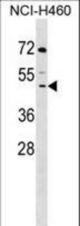DCPS Antibody western blot of NCI-H460 cell line lysates (35 ug/lane). The DCPS antibody detected the DCPS protein (arrow).