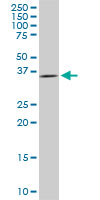 DCPS monoclonal antibody (M03), clone 3E5. Western blot of DCPS expression in PC-12.