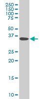 DCPS monoclonal antibody (M03), clone 3E5 Western blot of DCPS expression in HeLa.