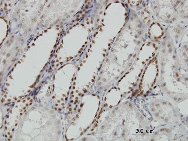 Immunoperoxidase of monoclonal antibody to DCPS on formalin-fixed paraffin-embedded human kidney. [antibody concentration 1.5 ug/ml]