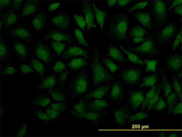 Immunofluorescence of monoclonal antibody to DCPS on HeLa cell. [antibody concentration 10 ug/ml]