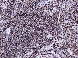 IHC of paraffin-embedded Human lymph node tissue using anti-DCPS mouse monoclonal antibody.