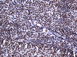 IHC of paraffin-embedded Human tonsil using anti-DCPS mouse monoclonal antibody.
