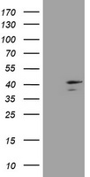 HEK293T cells were transfected with the pCMV6-ENTRY control (Left lane) or pCMV6-ENTRY DCPS (Right lane) cDNA for 48 hrs and lysed. Equivalent amounts of cell lysates (5 ug per lane) were separated by SDS-PAGE and immunoblotted with anti-DCPS.