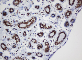 IHC of paraffin-embedded Human breast tissue using anti-DCPS mouse monoclonal antibody.