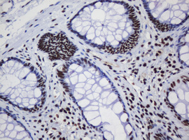 IHC of paraffin-embedded Human colon tissue using anti-DCPS mouse monoclonal antibody.