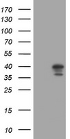HEK293T cells were transfected with the pCMV6-ENTRY control (Left lane) or pCMV6-ENTRY DCPS (Right lane) cDNA for 48 hrs and lysed. Equivalent amounts of cell lysates (5 ug per lane) were separated by SDS-PAGE and immunoblotted with anti-DCPS.