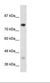 Jurkat Cell Lysate.