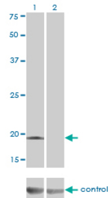 Western blot of DCTD over-expressed 293 cell line, cotransfected with DCTD Validated Chimera RNAi (Lane 2) or non-transfected control (Lane 1). Blot probed with DCTD monoclonal antibody (M01), clone 4B9. GAPDH ( 36.1 kD ) used as specificity and