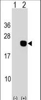 Western blot of DCTD (arrow) using rabbit polyclonal DCTD Antibody. 293 cell lysates (2 ug/lane) either nontransfected (Lane 1) or transiently transfected (Lane 2) with the DCTD gene.
