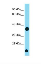 Western blot of Mouse Heart. Dcun1d2 antibody dilution 1.0 ug/ml.