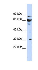 DCUN1D3 antibody LS-C111501 Western blot of Fetal Kidney lysate.
