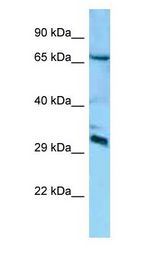 DCUN1D4 antibody Western Blot of Mouse Brain.