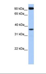 Fetal heart lysate. Antibody concentration: 1.0 ug/ml. Gel concentration: 12%.