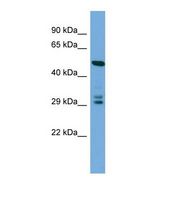 Western blot of Human HepG2. DCUN1D4 antibody dilution 1.0 ug/ml.