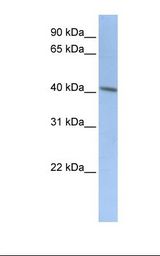 HepG2 cell lysate. Antibody concentration: 1.0 ug/ml. Gel concentration: 12%.