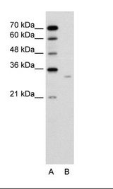 A: Marker, B: Jurkat Cell Lysate