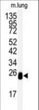 Western blot of anti-DCXR Antibody in mouse lung tissue lysates (35 ug/lane). DCXR (arrow) was detected using the purified antibody.