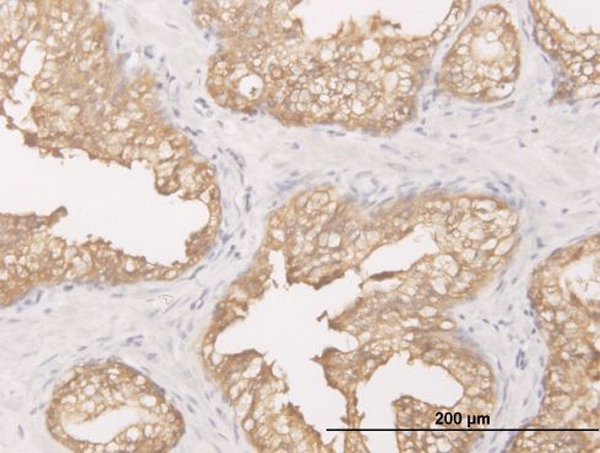 Immunoperoxidase of monoclonal antibody to DCXR on formalin-fixed paraffin-embedded human prostate. [antibody concentration 1 ug/ml]