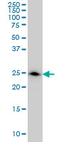 DCXR monoclonal antibody (M03), clone 6A6 Western blot of DCXR expression in A-431.