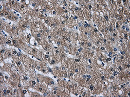 IHC of paraffin-embedded liver tissue using anti-DCXR mouse monoclonal antibody. (Dilution 1:50).