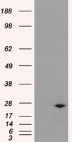 HEK293T cells were transfected with the pCMV6-ENTRY control (Left lane) or pCMV6-ENTRY DCXR (Right lane) cDNA for 48 hrs and lysed. Equivalent amounts of cell lysates (5 ug per lane) were separated by SDS-PAGE and immunoblotted with anti-DCXR.