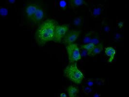 Anti-DCXR mouse monoclonal antibody immunofluorescent staining of COS7 cells transiently transfected by pCMV6-ENTRY DCXR.