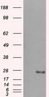 HEK293T cells were transfected with the pCMV6-ENTRY control (Left lane) or pCMV6-ENTRY DCXR (Right lane) cDNA for 48 hrs and lysed. Equivalent amounts of cell lysates (5 ug per lane) were separated by SDS-PAGE and immunoblotted with anti-DCXR.