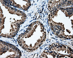 IHC of paraffin-embedded prostate tissue using anti-DCXR mouse monoclonal antibody. (Dilution 1:50).
