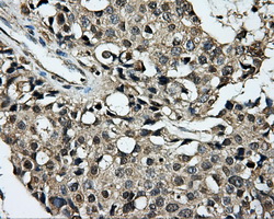 IHC of paraffin-embedded liver tissue using anti-DCXR mouse monoclonal antibody. (Dilution 1:50).