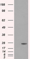 HEK293T cells were transfected with the pCMV6-ENTRY control (Left lane) or pCMV6-ENTRY DCXR (Right lane) cDNA for 48 hrs and lysed. Equivalent amounts of cell lysates (5 ug per lane) were separated by SDS-PAGE and immunoblotted with anti-DCXR.