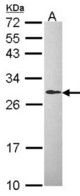 Sample (30 ug of whole cell lysate). A: Hep G2 . 12% SDS PAGE. DCXR antibody diluted at 1:1000.