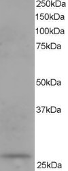 Antibody staining (0.1 ug/ml) of human kidney lysate (RIPA buffer, 35 ug total protein per lane). Primary incubated for 1 hour. Detected by Western blot of chemiluminescence.