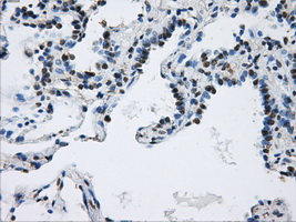 IHC of paraffin-embedded lung tissue using anti-DCXR mouse monoclonal antibody. (Dilution 1:50).
