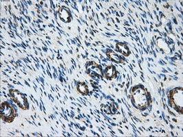IHC of paraffin-embedded Ovary tissue using anti-DCXR mouse monoclonal antibody. (Dilution 1:50).