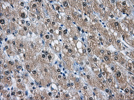 IHC of paraffin-embedded liver tissue using anti-DCXR mouse monoclonal antibody. (Dilution 1:50).