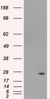 HEK293T cells were transfected with the pCMV6-ENTRY control (Left lane) or pCMV6-ENTRY DCXR (Right lane) cDNA for 48 hrs and lysed. Equivalent amounts of cell lysates (5 ug per lane) were separated by SDS-PAGE and immunoblotted with anti-DCXR.