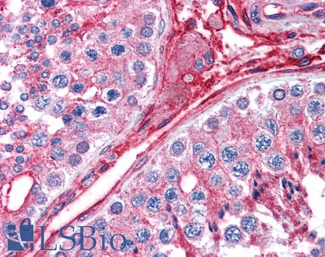 Anti-CYBRD1 / DCYTB antibody IHC of human testis. Immunohistochemistry of formalin-fixed, paraffin-embedded tissue after heat-induced antigen retrieval. Antibody LS-B4448 concentration 2.5 ug/ml.