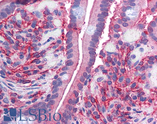 Anti-CYBRD1 / DCYTB antibody IHC of human small intestine. Immunohistochemistry of formalin-fixed, paraffin-embedded tissue after heat-induced antigen retrieval. Antibody LS-B4448 concentration 2.5 ug/ml.