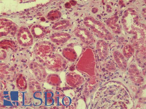 Anti-DDA1 antibody IHC staining of human kidney. Immunohistochemistry of formalin-fixed, paraffin-embedded tissue after heat-induced antigen retrieval. Antibody LS-B9572 concentration 5 ug/ml.