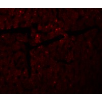 Immunofluorescence of DDA1 in mouse heart tissue with DDA1 antibody at 20 µg/mL.
