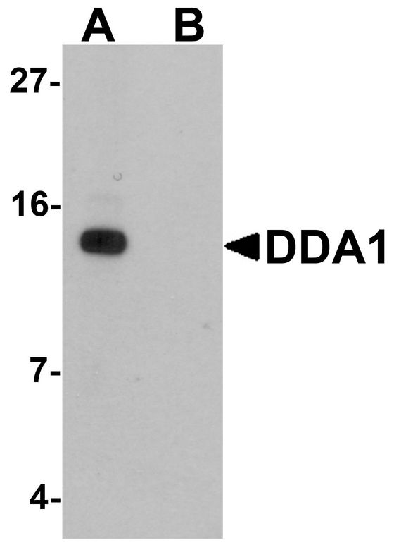 Western blot analysis of DDA1 in mouse heart tissue lysate with DDA1 antibody at 1 ug/ml in (A) the absence and (B) the presence of blocking peptide