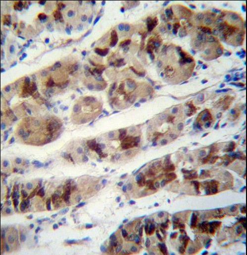 PCIA1 Antibody immunohistochemistry of formalin-fixed and paraffin-embedded human stomach tissue followed by peroxidase-conjugated secondary antibody and DAB staining.