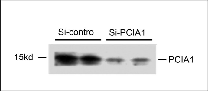 Western blot of extracts from 293T cells that were transfected with si-control or transfected si-PCIA1, using rabbit polyclonal PCIA1 Antibody.